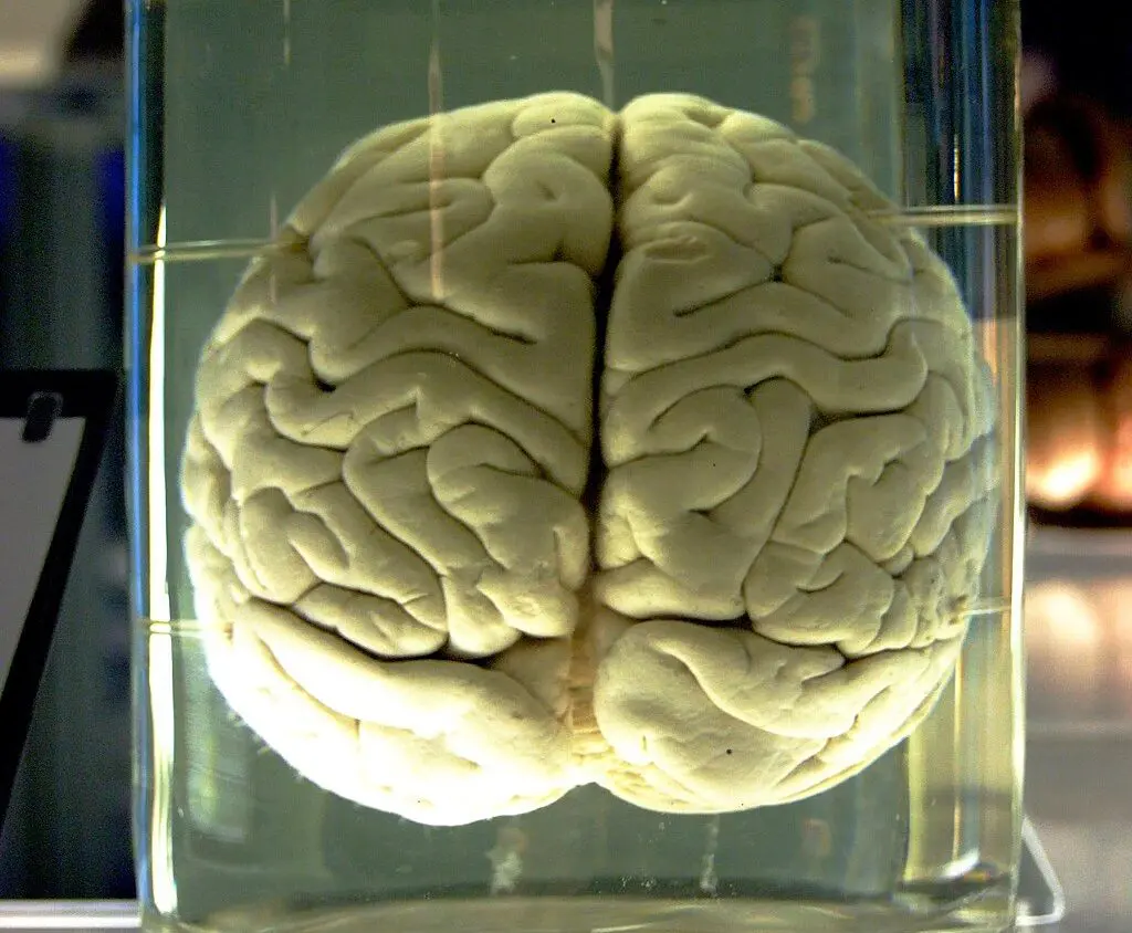 doença cerebral