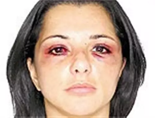 sandra x netinho - agressão
