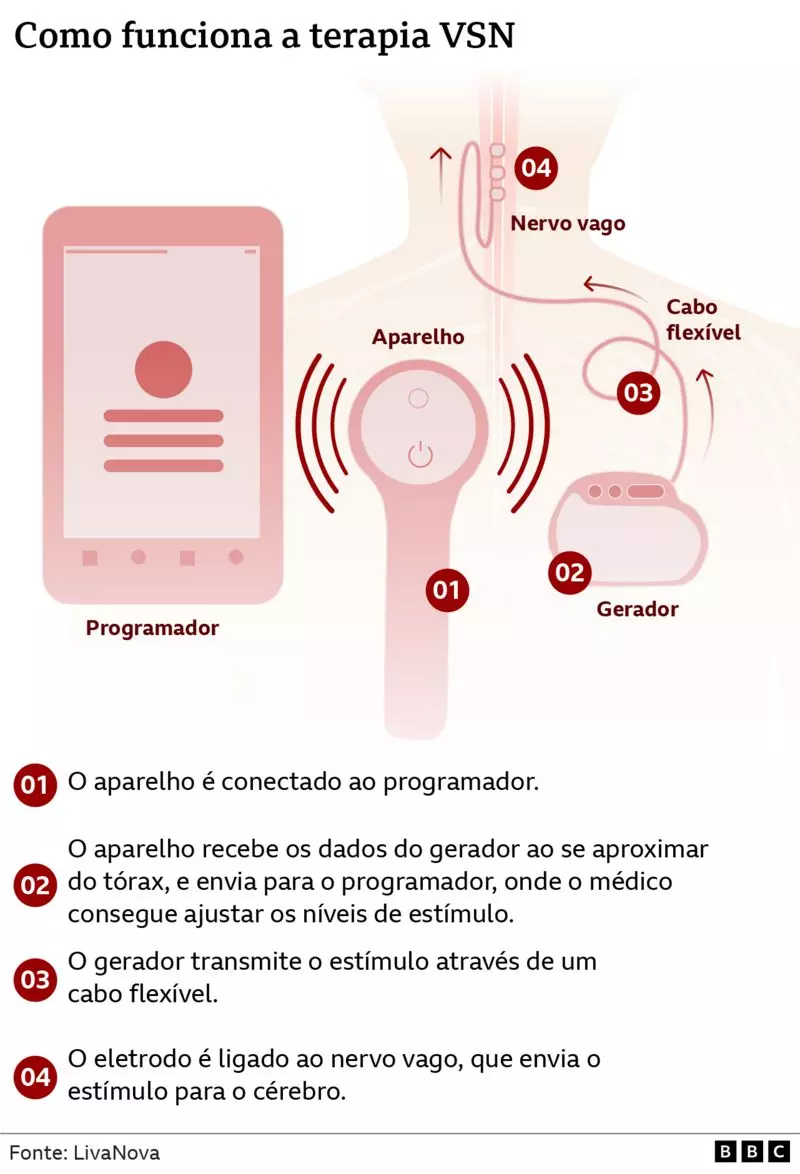 implante depressão 2