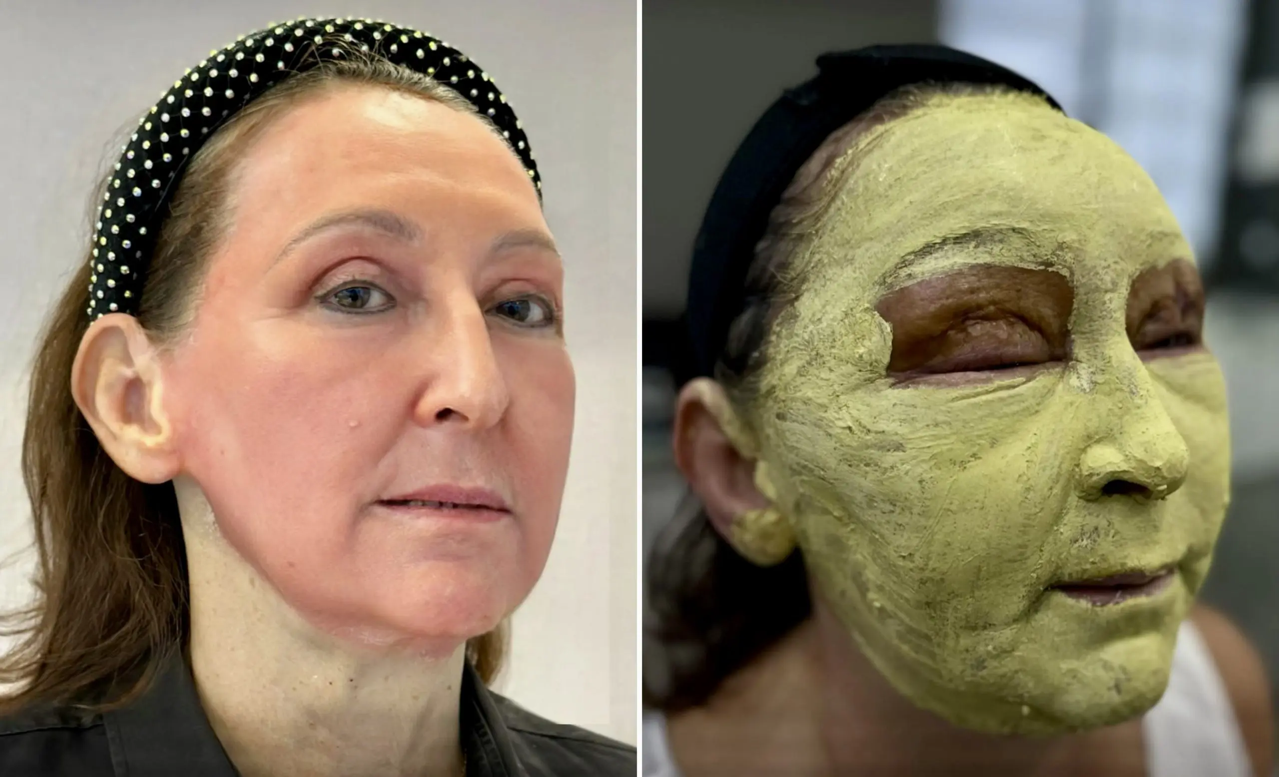 Peeling de fenol