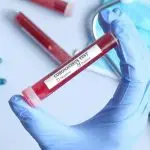 Teste Coronavírus