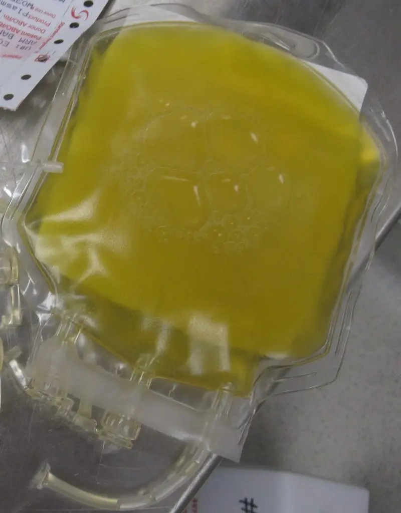 Uma bolsa com o plasma sanguíneo