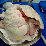 Um pulmão pronto para ser transplantado
