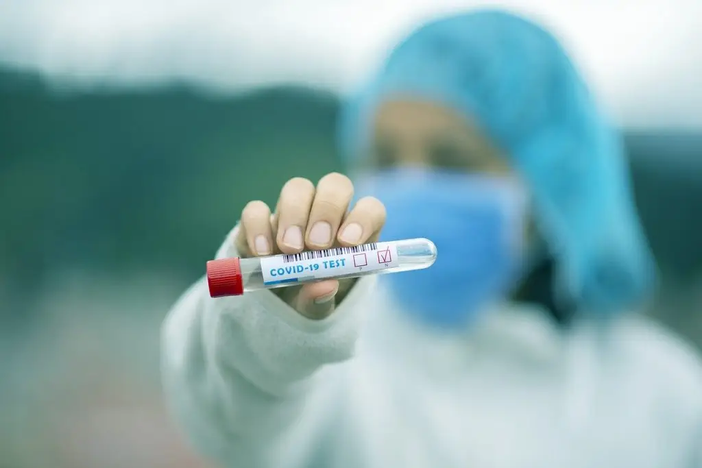 Israel - testes - coronavírus - pandemia
