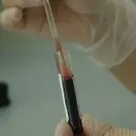 diagnósticos de câncer - pandemia