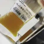 plasma