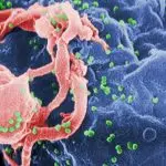 HIV