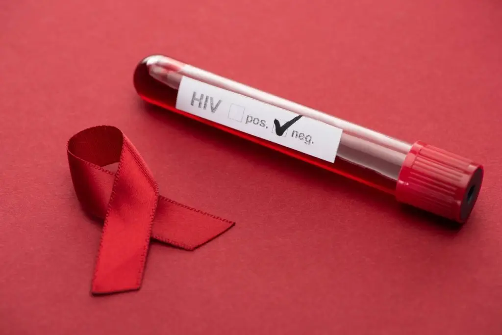hiv