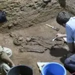 Esqueleto humano amputado