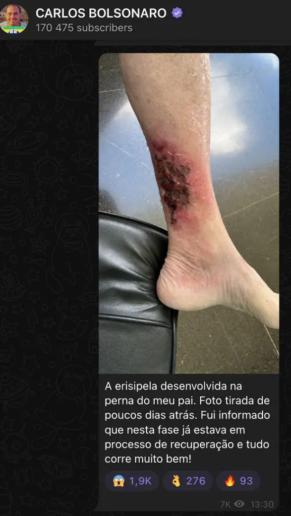 perna de bolsonaro