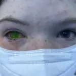 doença olho verde