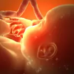 México Aborto