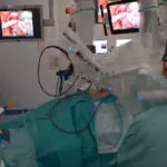 Robô faz transplante pulmonar na Espanha