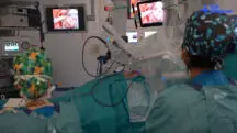 Robô faz transplante pulmonar na Espanha