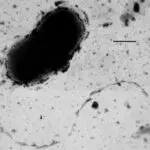 Parkinson