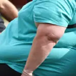proibir obesidade