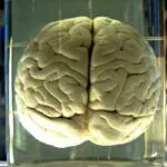doença cerebral