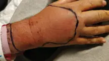 bactéria desconhecida
