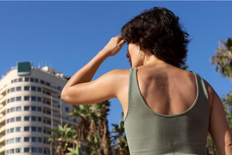 Inverno começa com calor este ano | Foto: Freepik