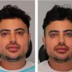 homem viraliza procedimento cor olhos