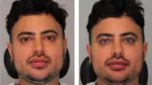 homem viraliza procedimento cor olhos
