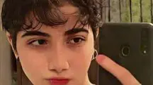 Iraniana ferida coma