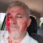 jornalista esfaqueado por vereador do pt - cocal - piauí