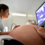 Lei obriga mulheres a verem imagens do feto antes do aborto 