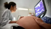 Lei obriga mulheres a verem imagens do feto antes do aborto 