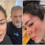 Fernanda e Vicente gravam vídeo mostrando ferimentos que sofreram durante acampamento na Índia