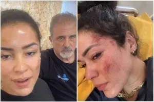 Fernanda e Vicente gravam vídeo mostrando ferimentos que sofreram durante acampamento na Índia