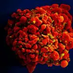 Célula infectada por partículas do vírus HIV | Foto: Divulgação/National Institute of Allergy and Infectious Diseases (Niaid)