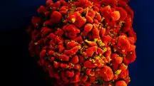Célula infectada por partículas do vírus HIV | Foto: Divulgação/National Institute of Allergy and Infectious Diseases (Niaid)