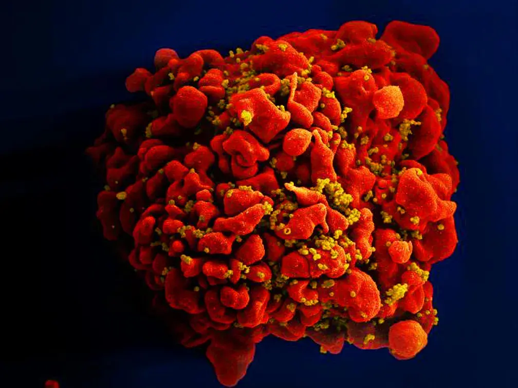 Célula infectada por partículas do vírus HIV | Foto: Divulgação/National Institute of Allergy and Infectious Diseases (Niaid)