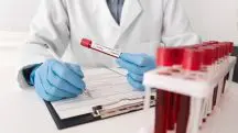 Imagem genérica mostrando frascos para colher material de exames de sangue