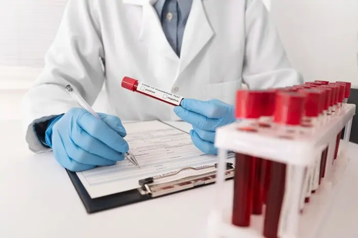 Imagem genérica mostrando frascos para colher material de exames de sangue