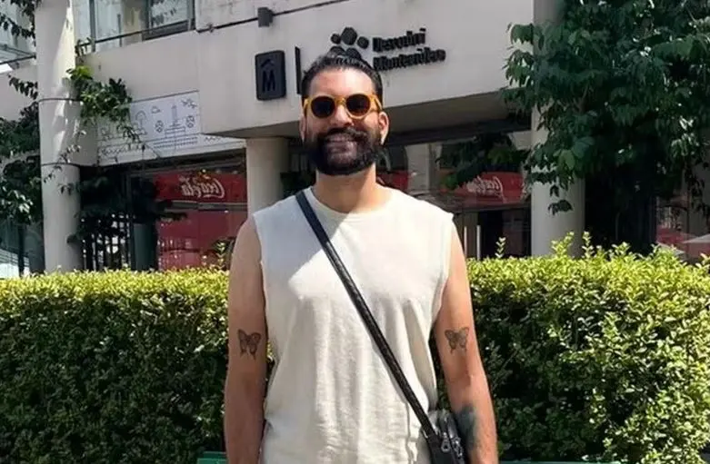 Henrique Chagas, empresário que fez peeling de fenol