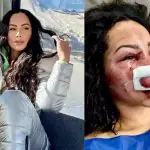 Brasileira é espancada durante assalto seguido de tentativa de estupro no Chile