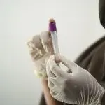 Exame de sangue laboratório dengue mosquito