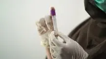 Exame de sangue laboratório dengue mosquito
