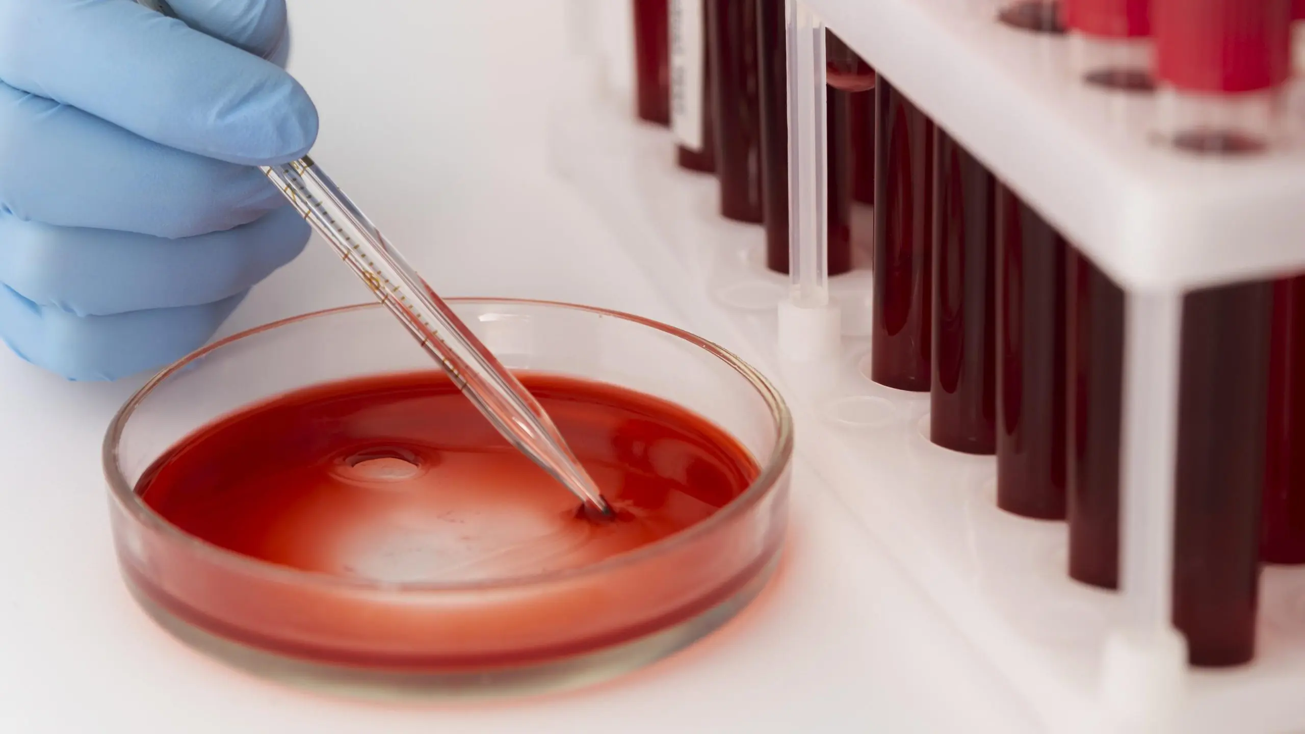 Os cientistas concluíram que algumas pessoas não possuem o novo grupo sanguíneo em virtude das doenças como câncer ou desordens hematológicas | Foto: Reprodução/Freepik