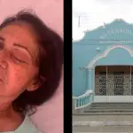 Matéria de oito pessoas que perderam o globo ocular depois de infecção em cirurgia de catarata