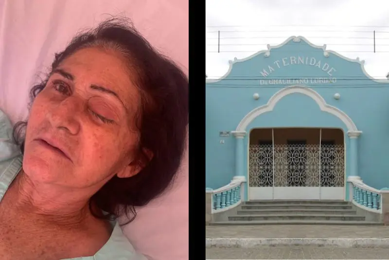 Matéria de oito pessoas que perderam o globo ocular depois de infecção em cirurgia de catarata