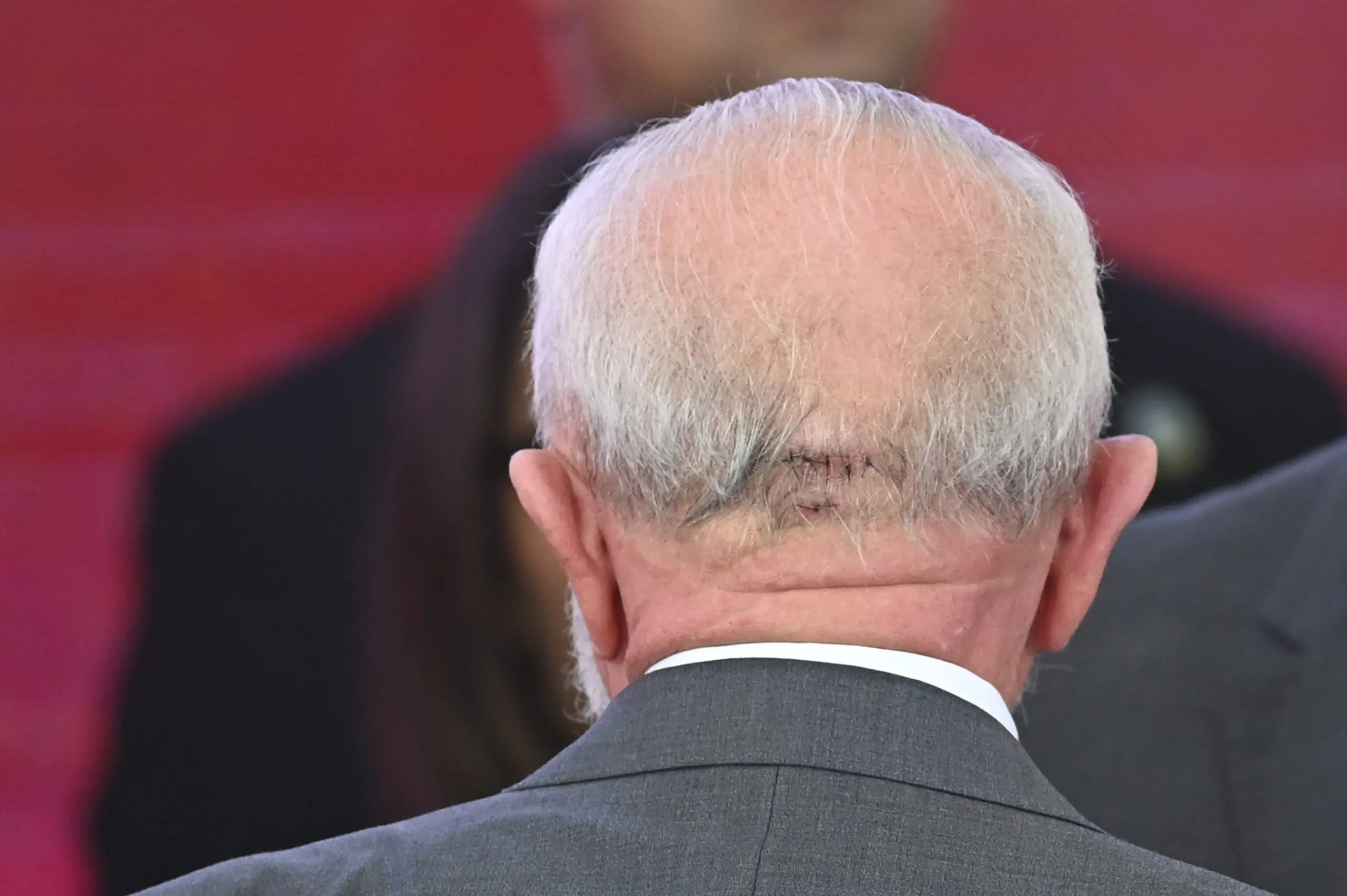 Ferimento/machucado de Lula