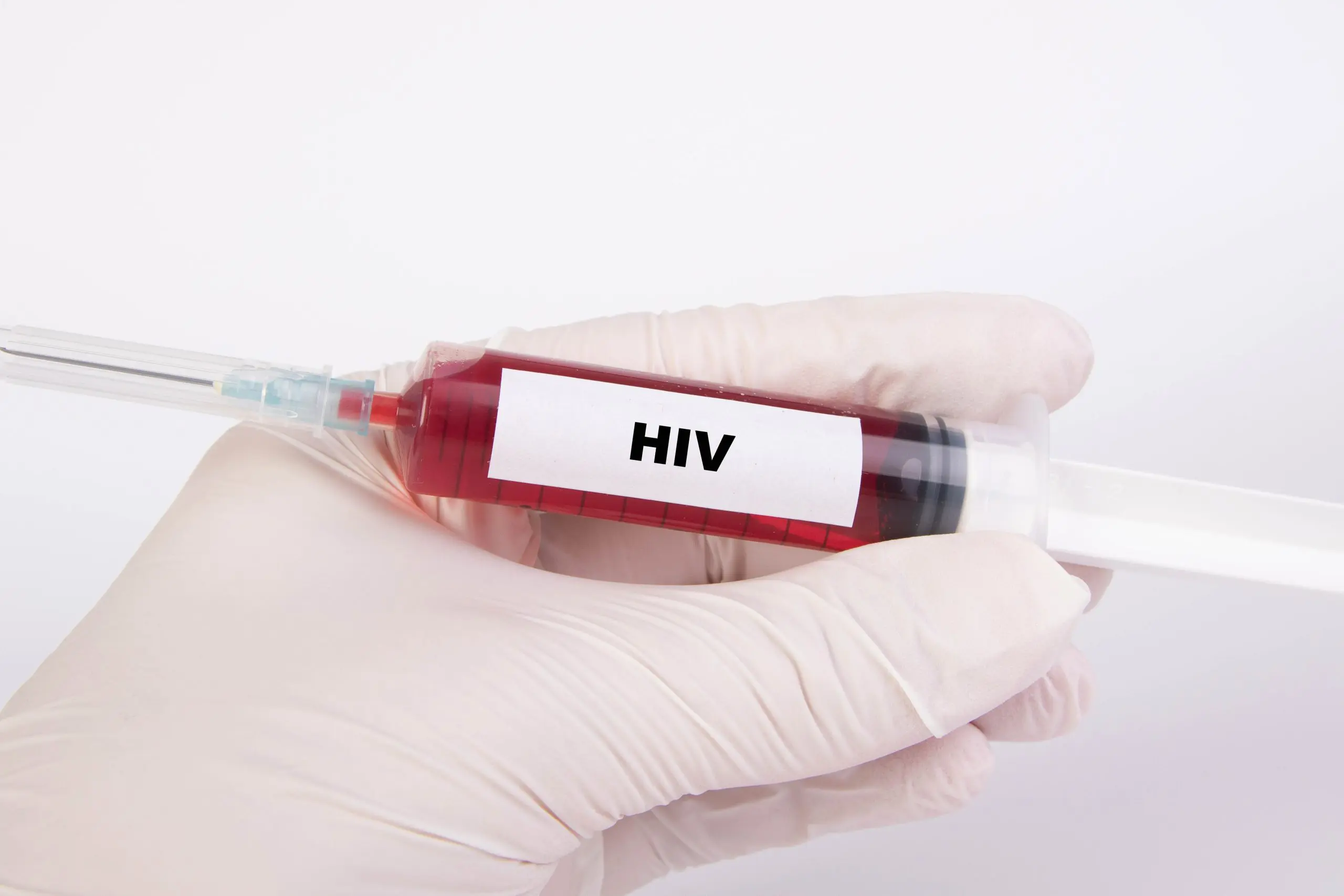 Crianças também receberam resultados falsos de exames de HIV | Foto: Reprodução/CCNull
