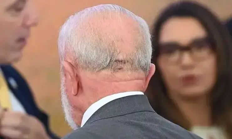 Lula sofreu acidente doméstico e precisou levar pontos | Foto: Ton Molina/Foto Arena/Estadão Conteúdo
