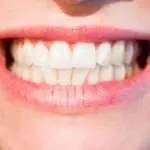 Dentes, pessoa sorrindo