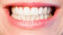 Dentes, pessoa sorrindo