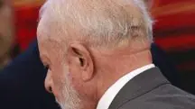 Lula está consciente e não terá sequelas da cirurgia que realizou na cabeça, nesta terça-feira, 9