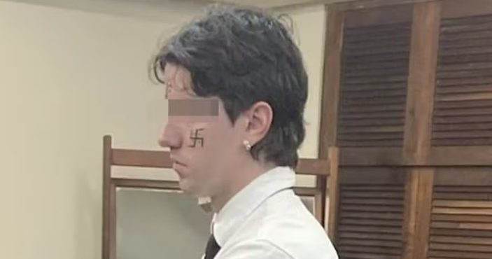 Vinicius Krug de Souza aceitou apagar o símbolo. Ele manteve outros desenhos no rosto sem relação com o nazismo | Foto: Reprodução/X